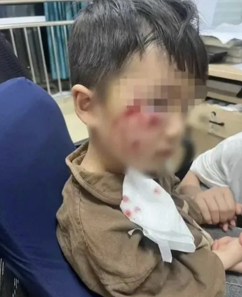 被瘋?cè)麤](méi)有“救命藥”，怎么辦？